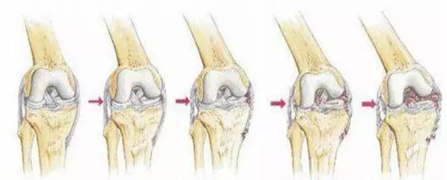 膝关节疼痛的十大原因怎么治疗,膝关节疼痛和什么疾病有关