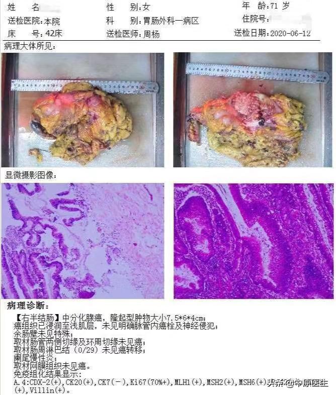 老人便血一年,70岁老人便血两年不去治能活多久