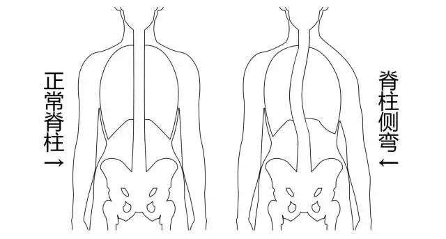 10岁孩子脊柱凸起是什么原因,10岁孩子后背脊柱突出图片