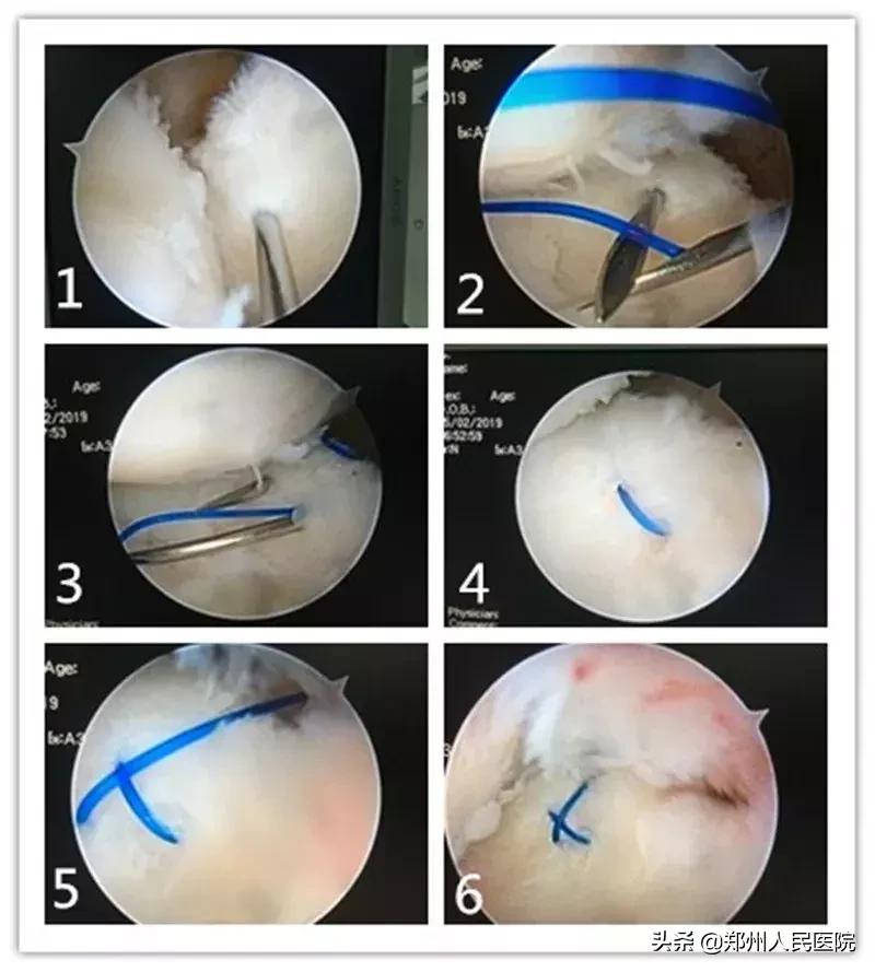 手腕疼10年了怎样治疗,20岁小伙手腕关节疼痛是怎么回事