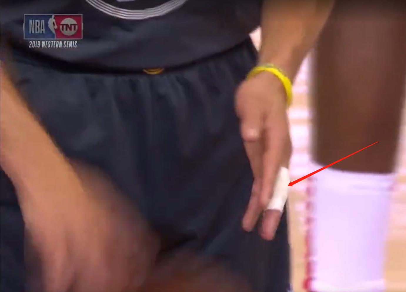 19年季后赛库里手指骨折后首秀,库里左手手指变形图片