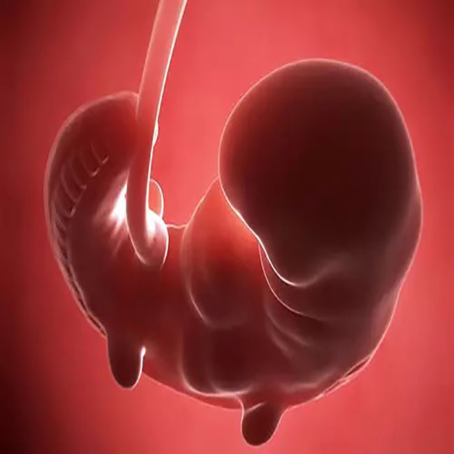 孕检未见卵黄囊什么意思,为什么孕检单子没有nt值