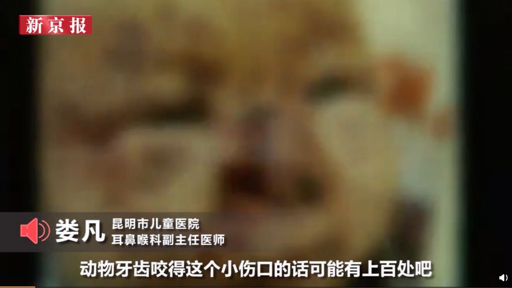 被老鼠咬伤要打狂犬疫苗吗,被老鼠咬伤后要不要打狂犬疫苗