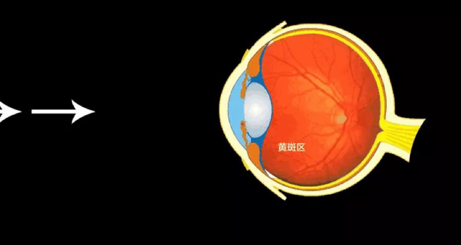 蓝光眼镜自动调焦骗局,网上的蓝光眼镜是真的吗