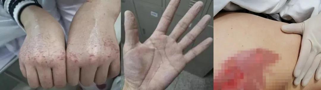 南方医院医疗队,南方医院支援武汉医疗队