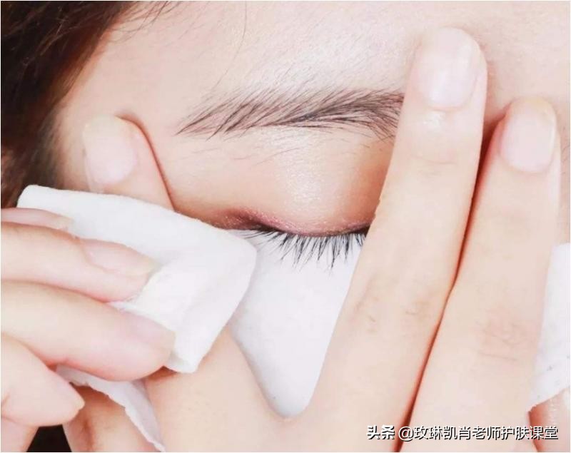 脸上闭合性粉刺如何去除最有效,闭口性粉刺是怎么回事