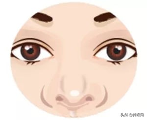 明星都在用的缩小鼻翼神器,明星鼻子做鼻翼缩小外切