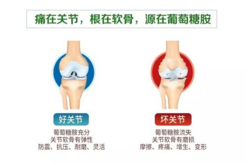 进口的氨基葡萄糖排名,进口氨基葡萄糖功效