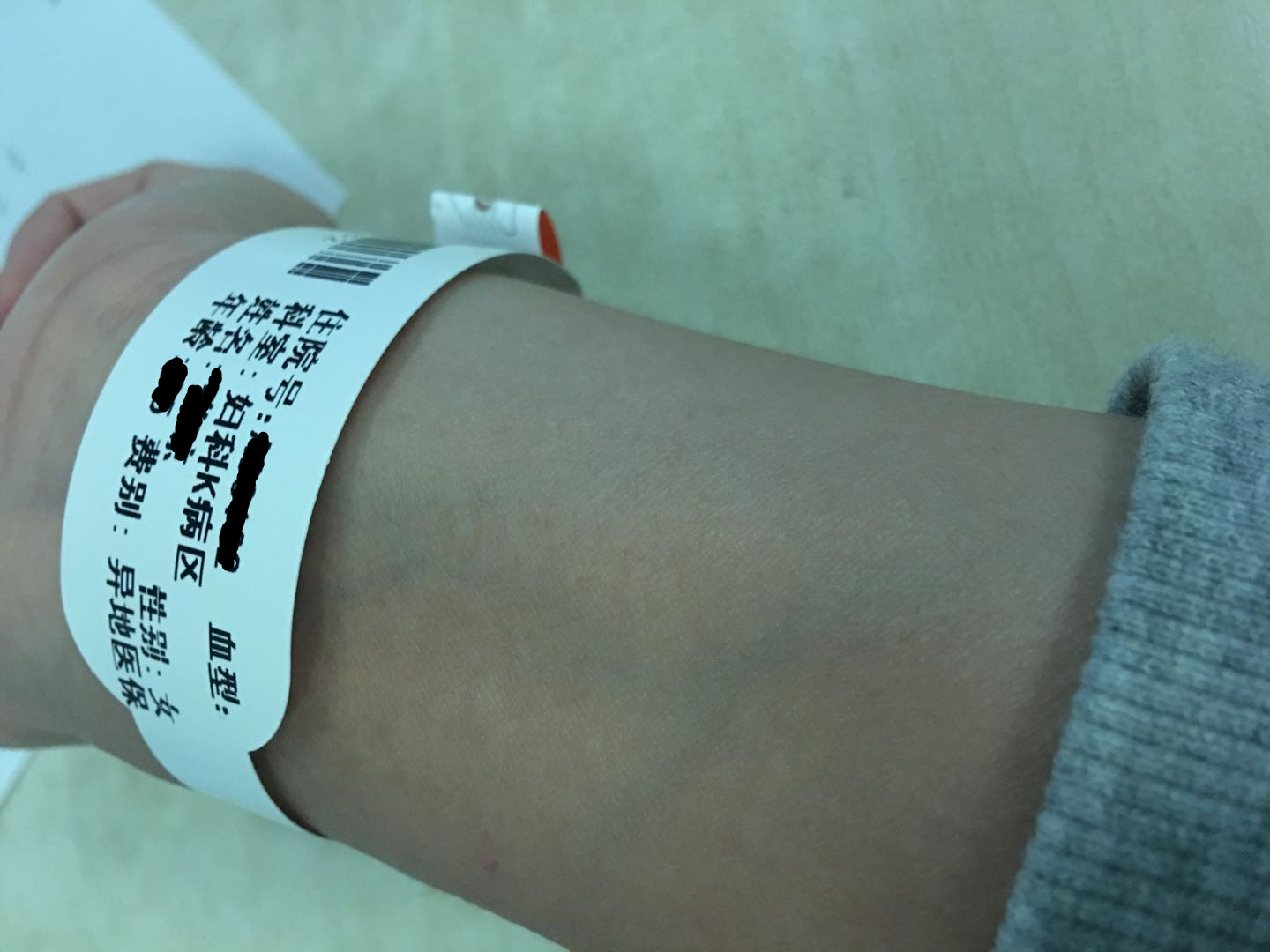 2次宫外孕的心酸,左右两侧都有过宫外孕的经历