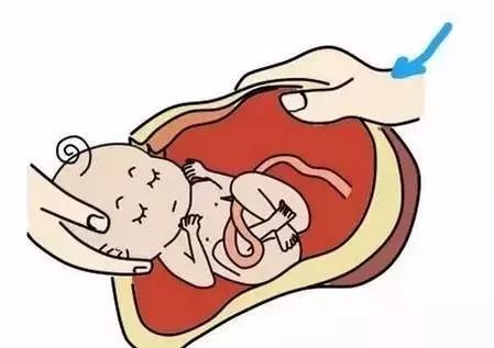 你的宝宝是顺产的还是剖腹产的,剖腹产一个月可做的训练