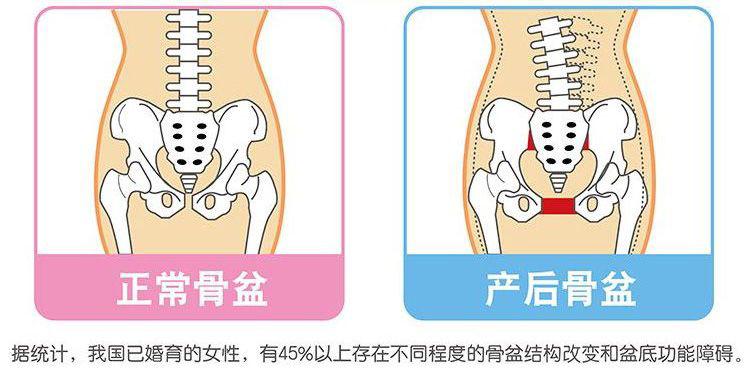 平躺后翻身困难腰疼怎么缓解,平躺后不敢翻身腰疼是怎么回事
