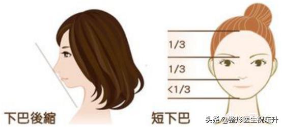 下巴假体好还是注射玻尿酸好,下巴是假体好还是玻尿酸好