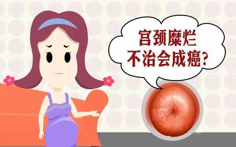 宫颈糜烂能治好吗能痊愈吗,宫颈糜烂能治好吗需要多久