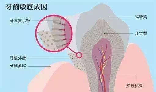 老了牙齿不好了可怎么办,人老了牙齿变稀了怎么办