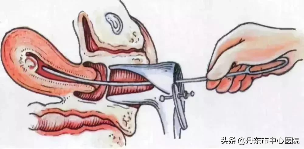 市民业余学习行动|发现自己意外怀孕了怎么办?