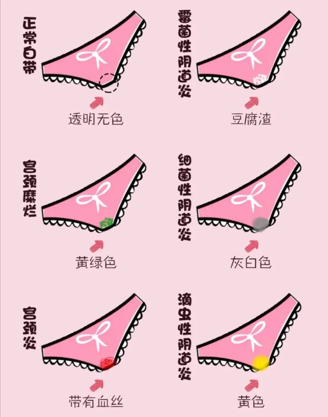 hpv疫苗接种注意事项及禁忌,月经期间可以接种hpv疫苗吗