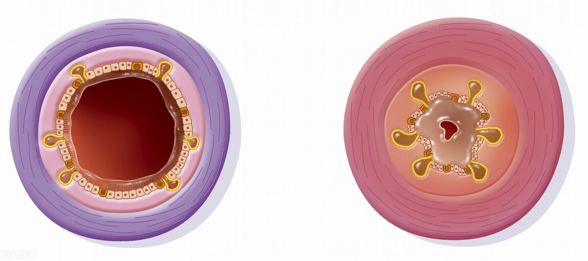 抽烟咳的黑痰是怎么回事,抽烟几十年了老是咳嗽是什么原因