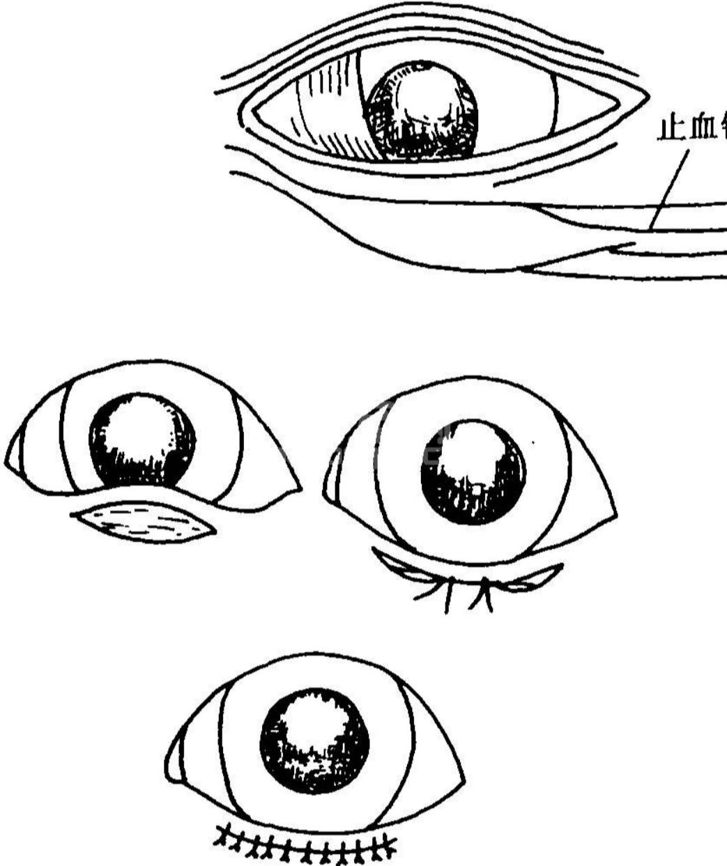 割双眼皮割反了,狗狗眼睑内翻手术