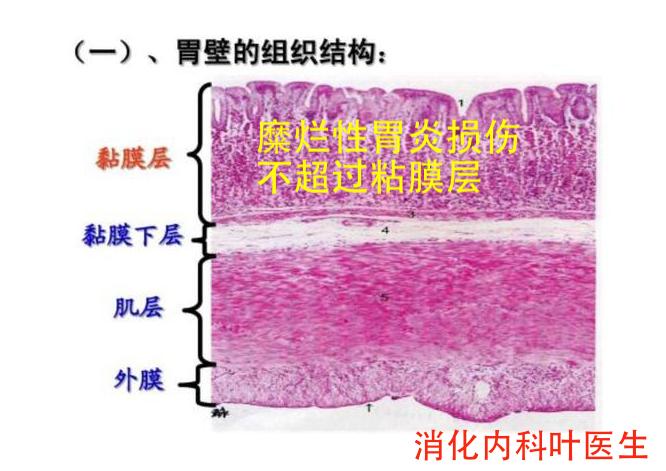 胃镜检查没问题但是一直烧心,胃镜检查没问题但是胃还是胀