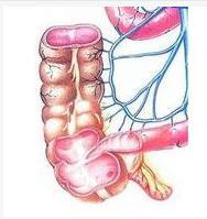 阑尾切除又发现了阑尾,切除的阑尾都去哪儿了