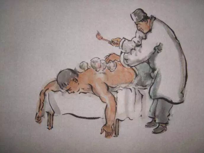 拔罐时出现罐印红是怎么回事,怎样快速消除拔罐留下的罐印