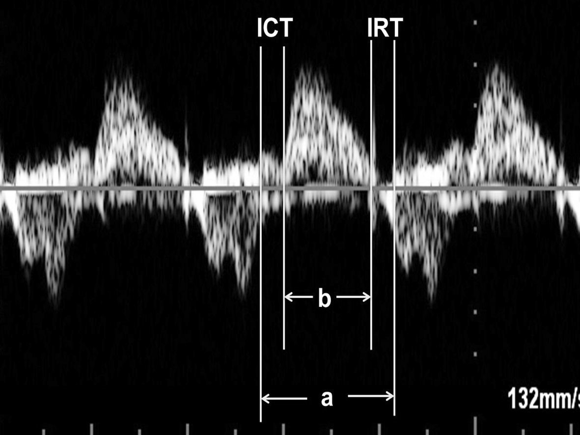 做普通的彩超能不能看到胎儿心脏,做彩超能知道胎儿准确多少周吗