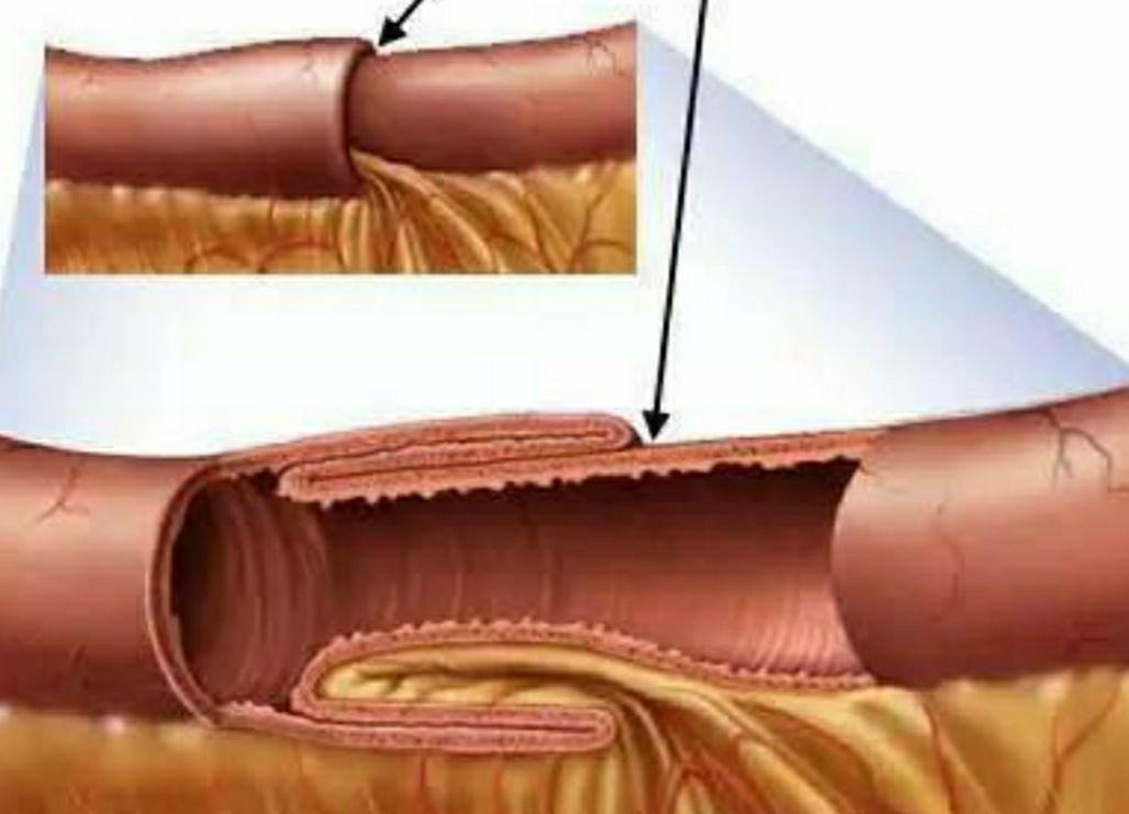 狗狗细小病毒恢复期拉血,狗狗得了细小病毒有抽搐症状