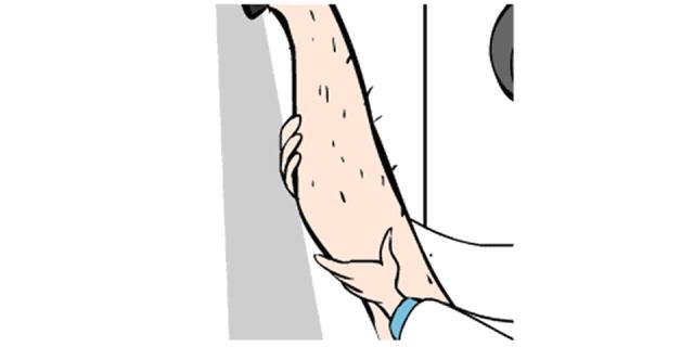 多毛用什么脱毛方法效果好,毛多如何脱毛