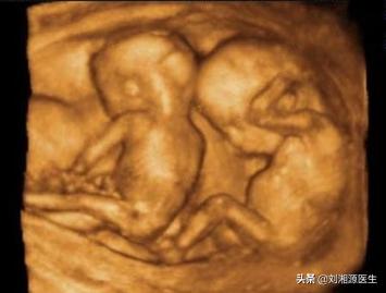 免疫治疗不良反应科普图文,免疫因素怀孕早期保胎几率大吗