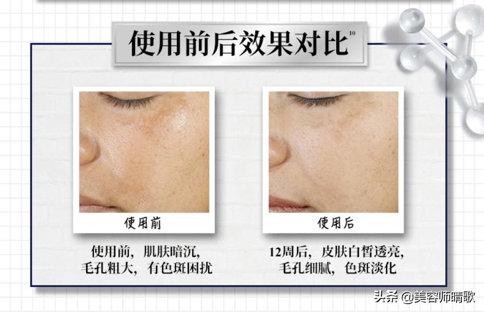 淡斑小白瓶精华二代,小白瓶美白淡斑护肤品推荐