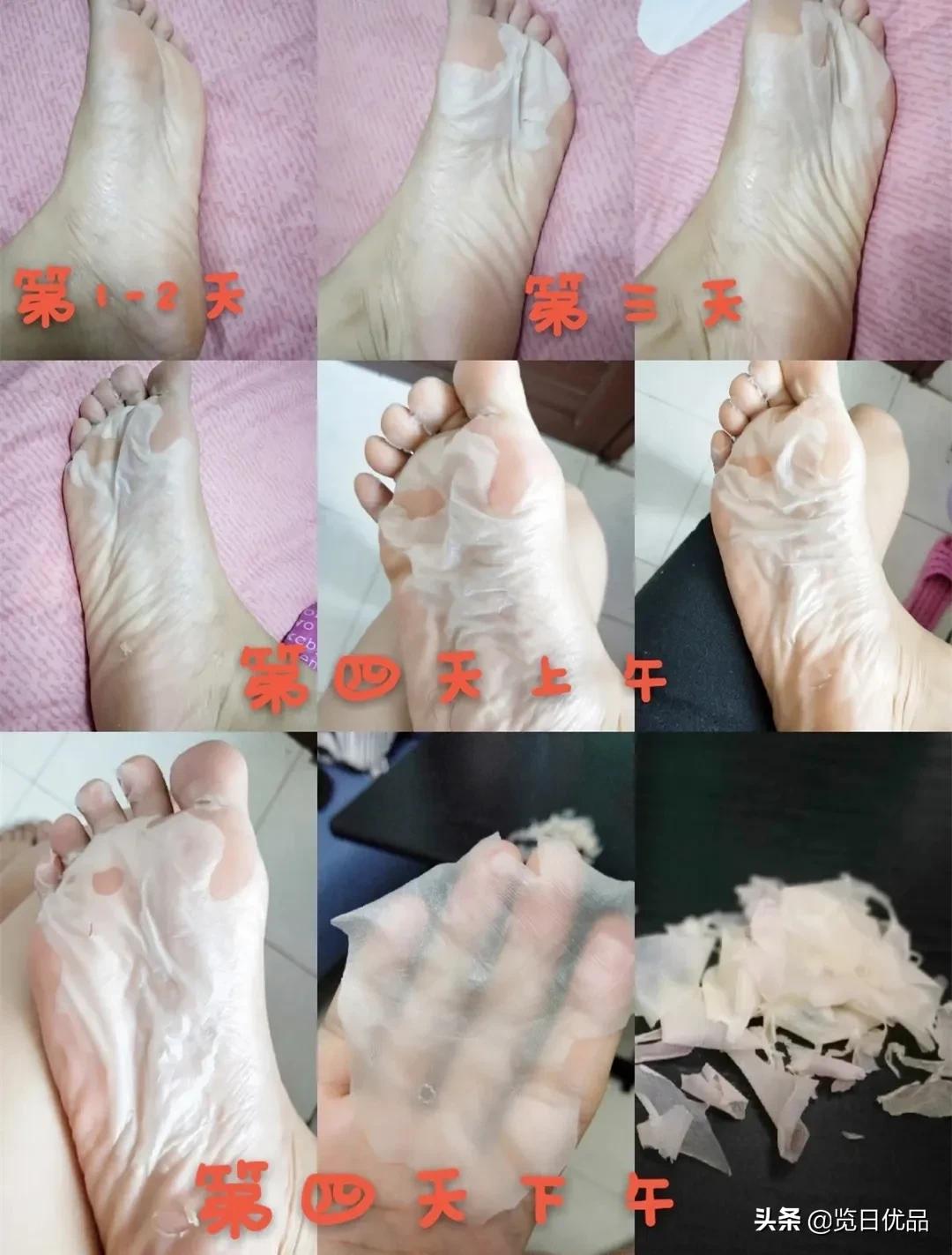 爽炸了!干丑裂的脚皮,一张完整撕掉,敢跟婴儿比姣嫩!