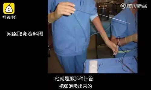 捐卵对女人有害吗,代孕捐卵是什么意思