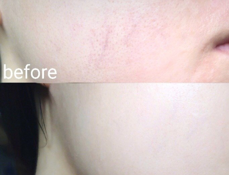 张馨予超爱的品牌！99元的眼霜，就能改善黑眼圈、干纹！