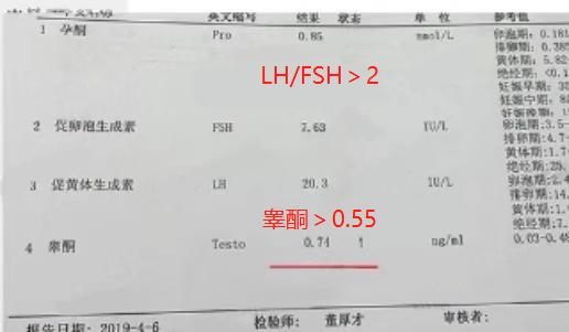 最新研究发现：原来医生一直开的激素药并不能真正根治月经