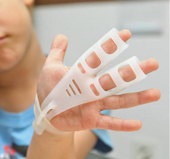 宝宝被门夹擦什么快好,婴儿被门夹伤该怎么办