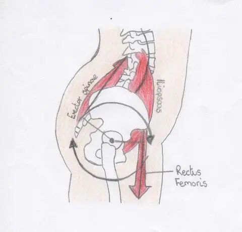 骶髂关节稳定性检查,怀孕后骶髂关节炎如何治疗