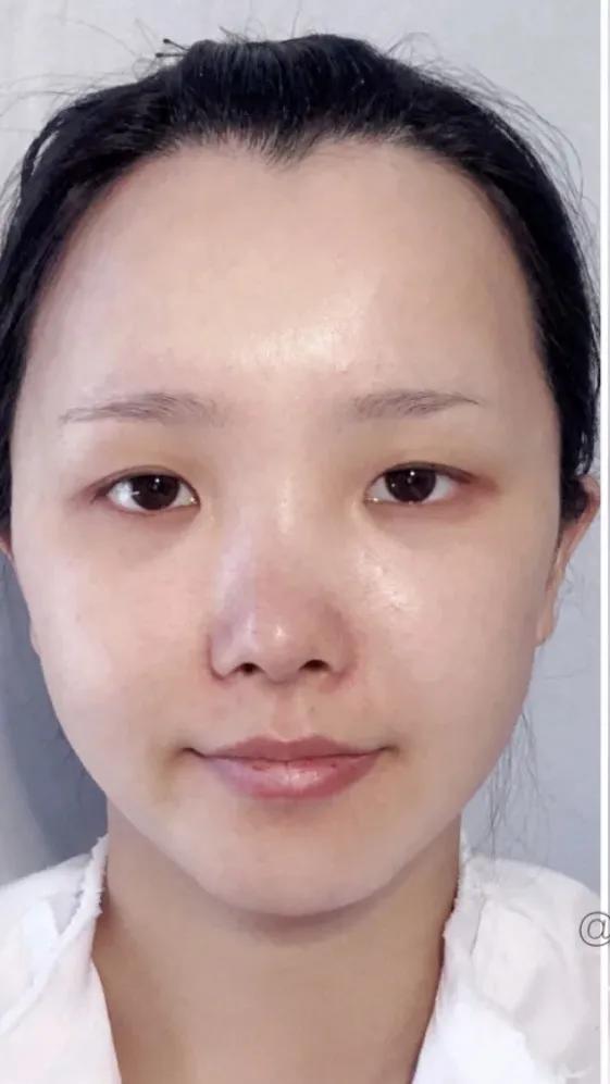 面部的美学曲线,面部艺术美学