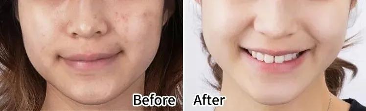 死海泥洗面膜怎么样,死海泥面膜的神奇功效是什么