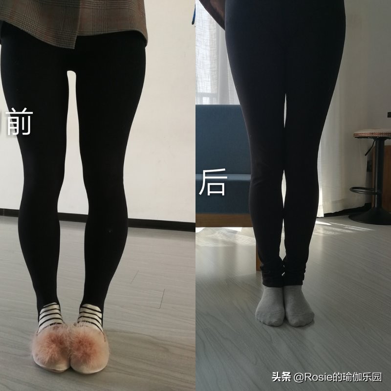 瘦腿针瘦小腿打完需要注意什么,打瘦腿针瘦腿医院哪个好