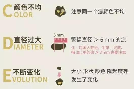 宝宝怎么越长越嫩,宝宝长了一个不规则的痣