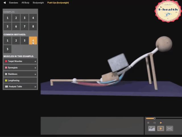 【运动损伤Respond】第一期，俯卧撑与肘关节疼痛。
