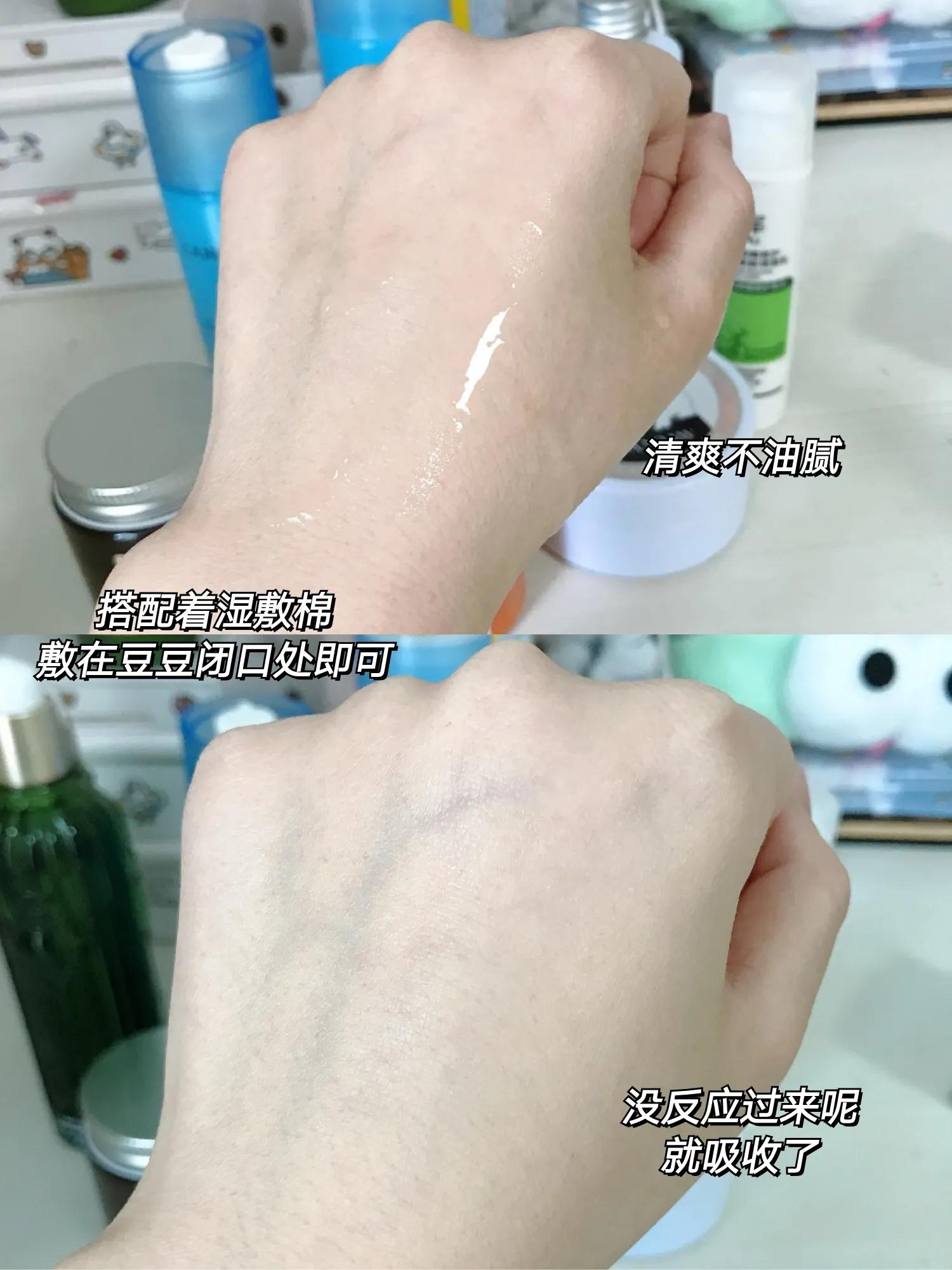 油痘肌水乳护肤品推荐,油痘肌水乳推荐骆王宇