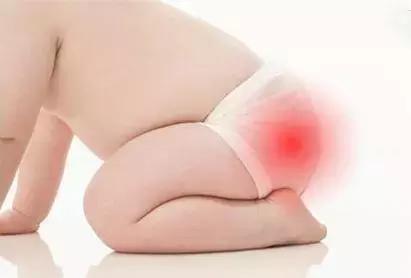 宝宝总是红屁股怎么办？三个关键词让宝妈不再有烦恼