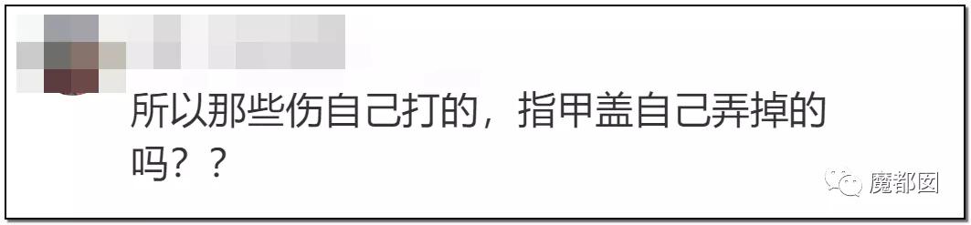 短跑名将张培萌被曝家暴反转,短跑名将张培萌家暴背后