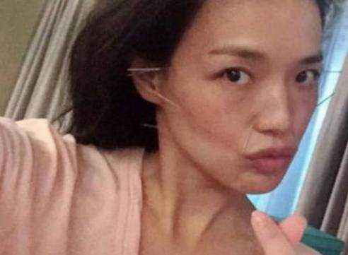 舒淇皮肤过敏,舒淇皮肤过敏化妆