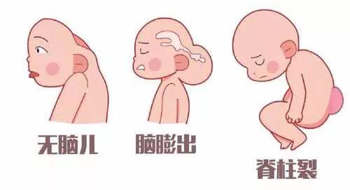 孕期如何科学补叶酸钙呢,孕期该怎么补叶酸和钙