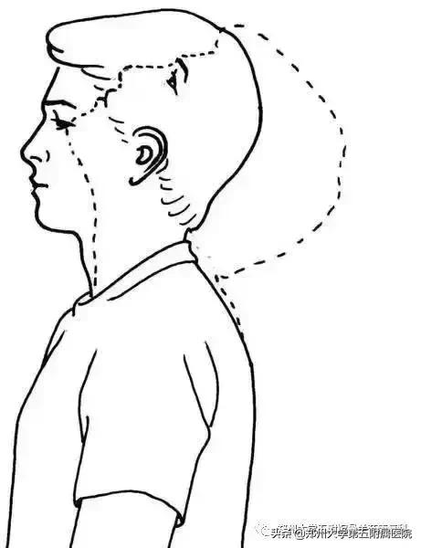 枕大神经痛是偏头疼吗,枕大神经痛能引起头痛吗