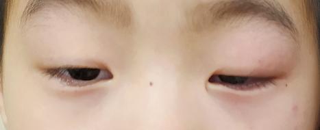 3岁小孩平时爱挑眉、耸肩，医生却说不是坏习惯？