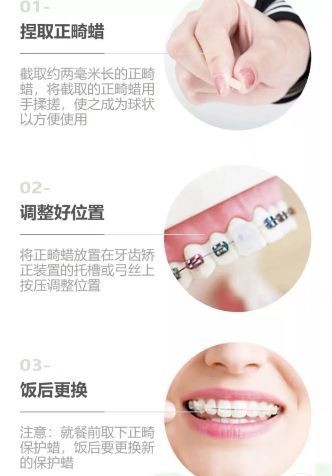 初戴牙套吃什么食物,单颗牙戴牙套怎么固定