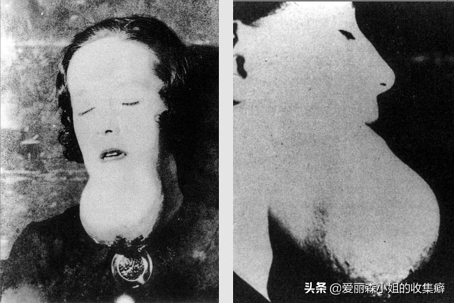 镭女郎是什么意思,镭女郎真实的悲剧故事